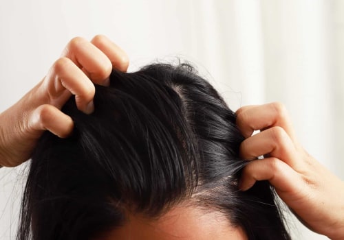 Anti-Aging Hair Treatment: Revitalize Your Hair in Orchard Singapore